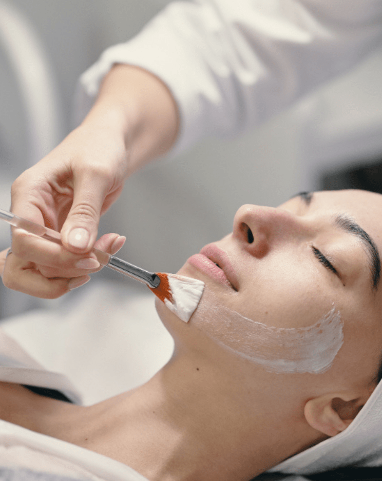 Pigmentation treatment in Panchkula